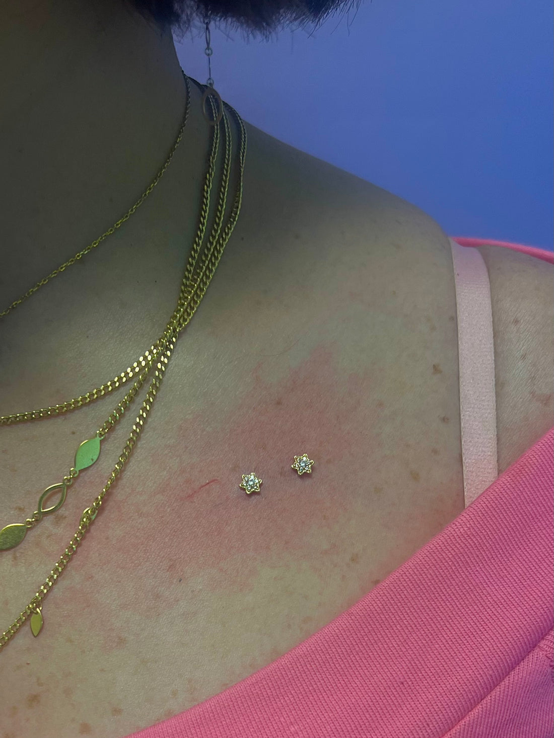 White Gold Flower Dermal Top