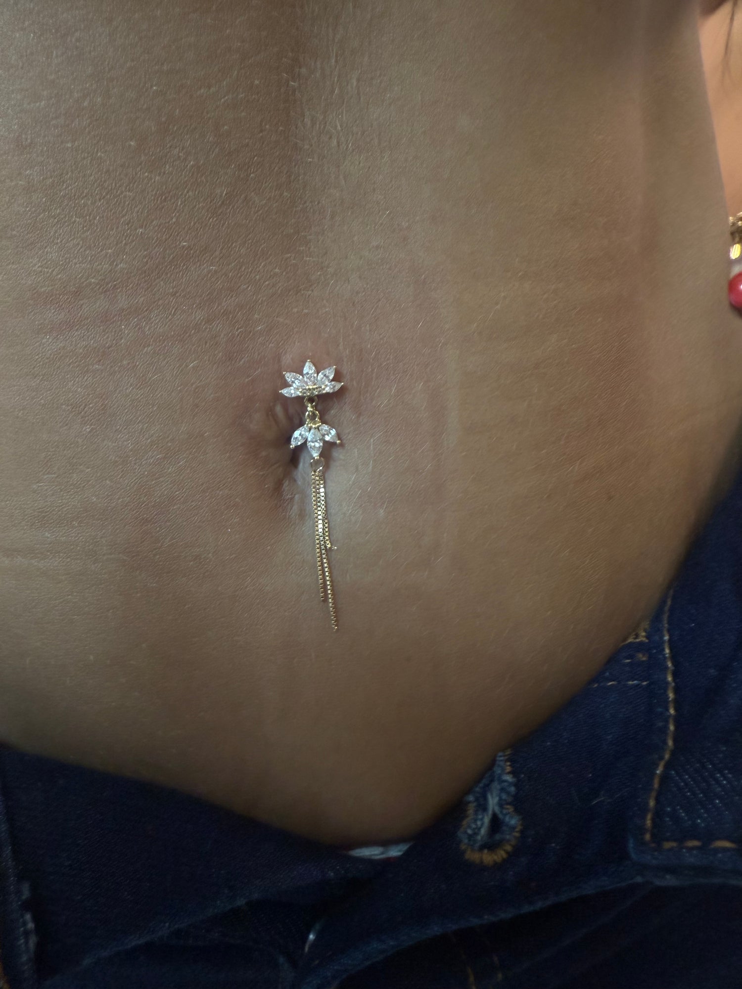 Étoile Royale Dermal Top