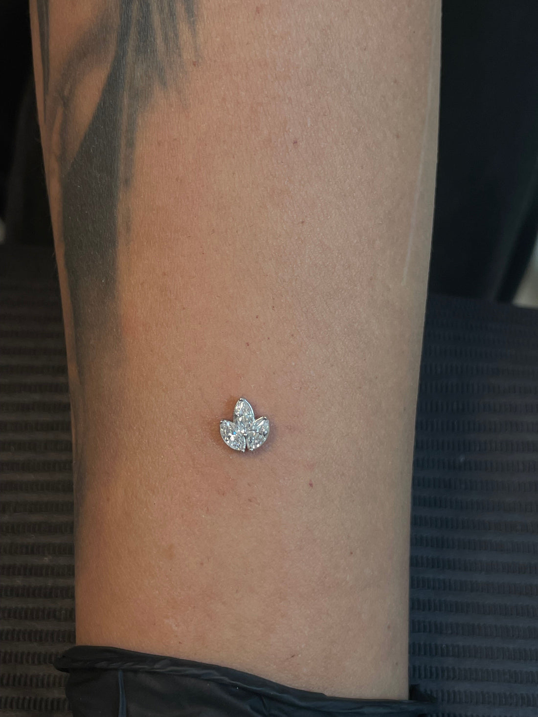 Diamond White Gold Lotus Dermal Top