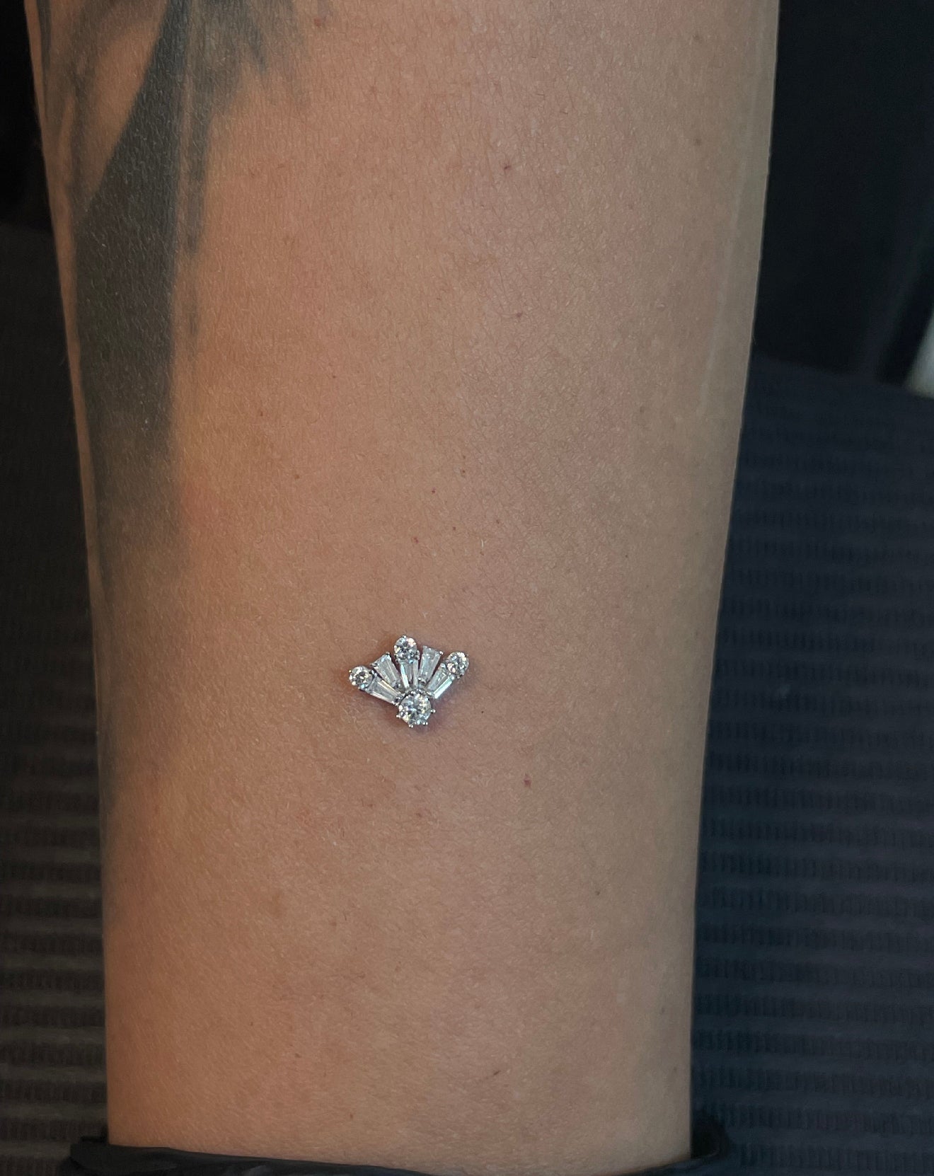 Gold Lumina Rays Dermal Top