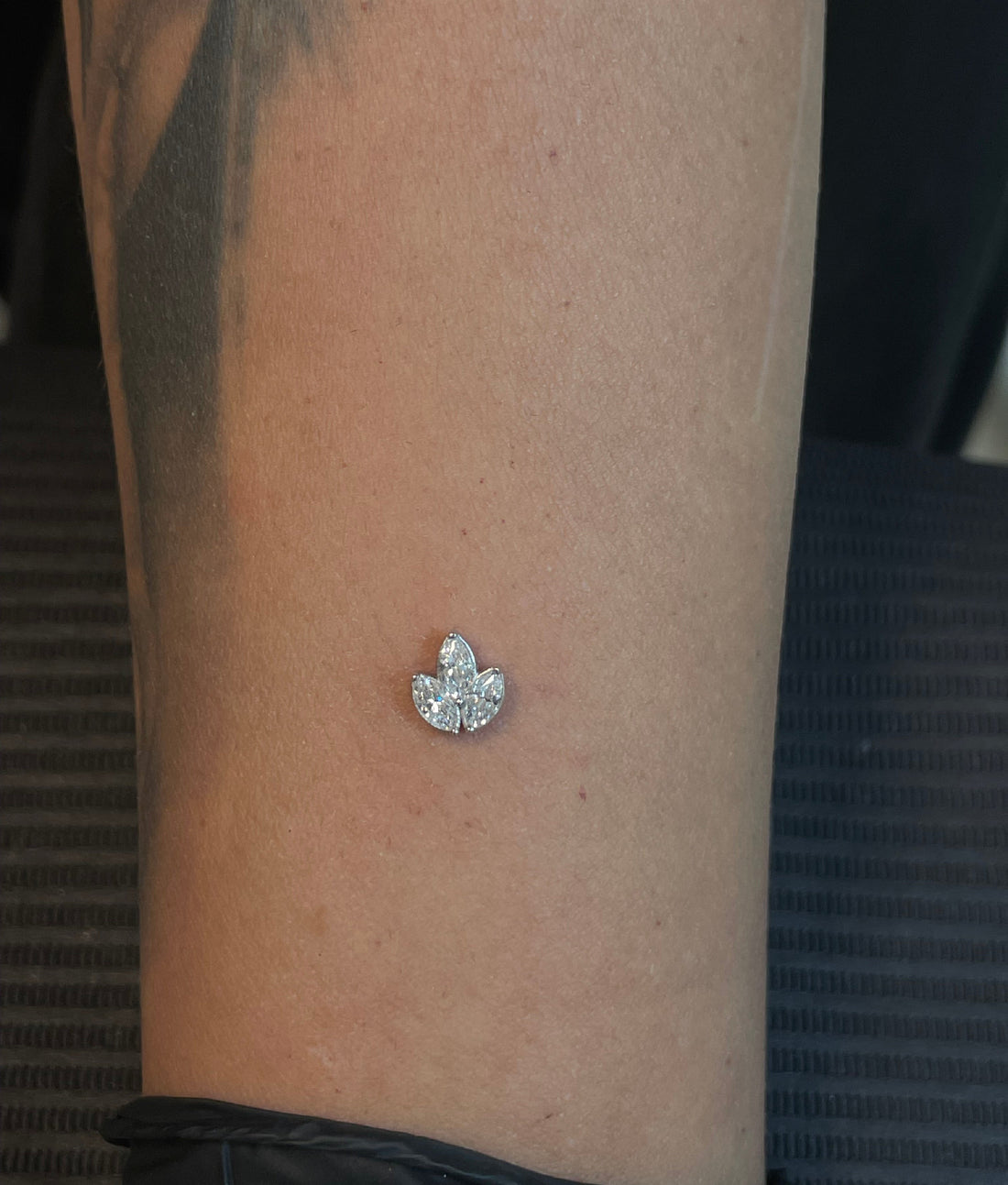 Gold Lotus Dermal Top